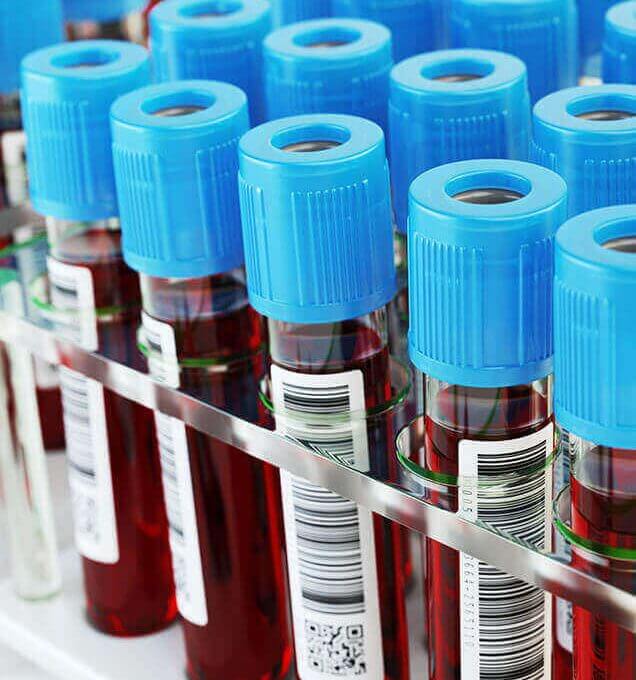 Lab Services Bottles