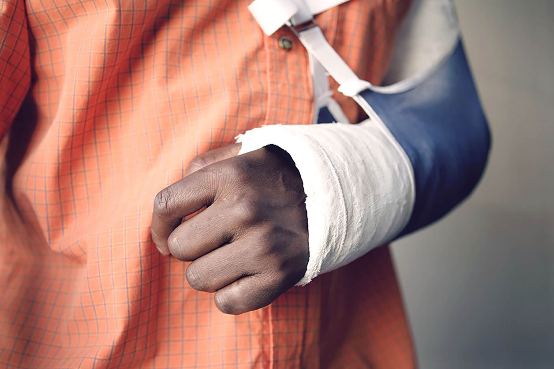 Broken Bones: When Should You Go to The Emergency Room?