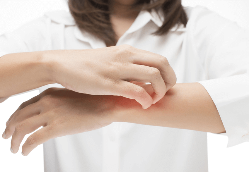 How to Tell if You Have a Skin Infection – Angleton ER
