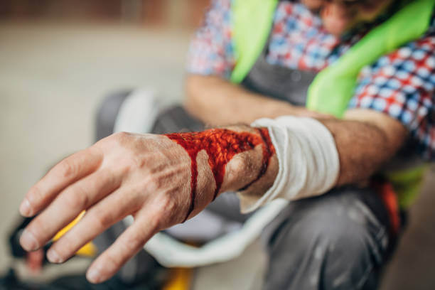 Coagulopathy: Symptoms, Causes, Treatment