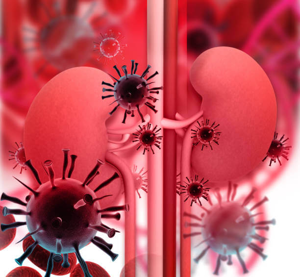 Kidney Pain: Symptoms, Causes, Treatment