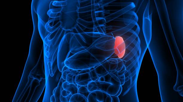 What is Spleen Pain (Splenomegaly)?